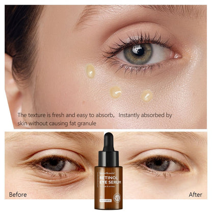 Rétinol sérum Eye