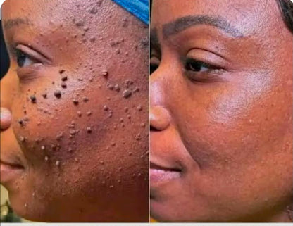 BEE VENOM CREAM