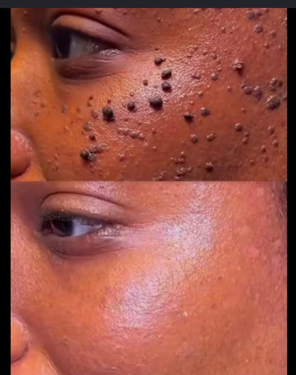 BEE VENOM CREAM